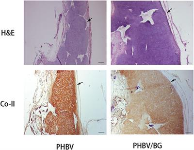 Integration of Bioglass Into PHBV-Constructed Tissue-Engineered Cartilages to Improve Chondrogenic Properties of Cartilage Progenitor Cells